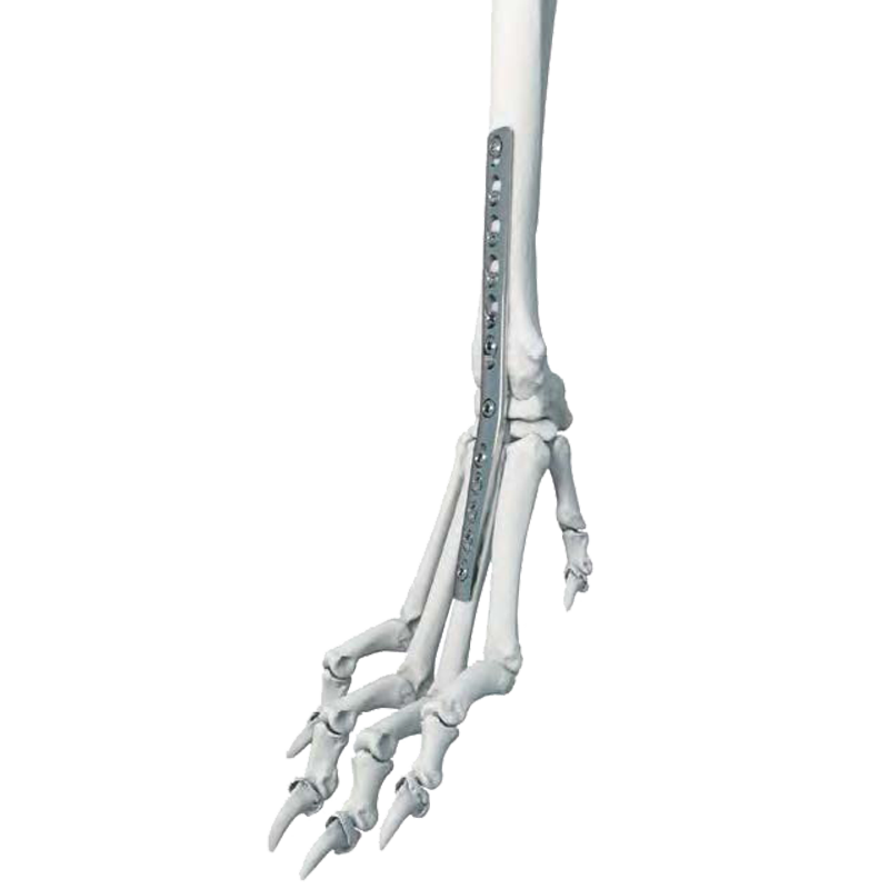 Pancarpal Arthrodesis Locking Plate