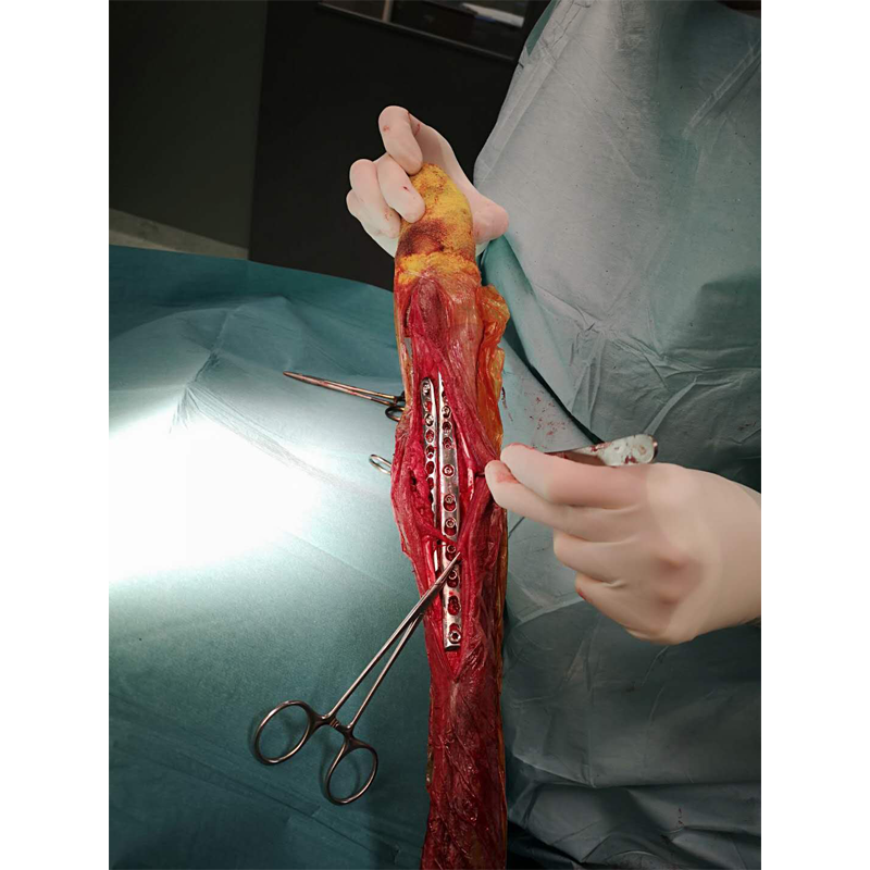 Pancarpal Arthrodesis Locking Plate
