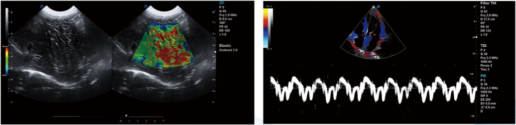 WMV-T8-VET VETERINARY COLOR DOPPLER ULTRASOUND SYSTEM