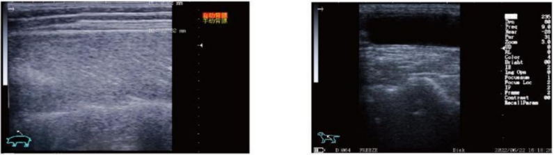 WMV-S1 VETERINARY ULTRASOUND DIAGNOSTIC SYSTEM