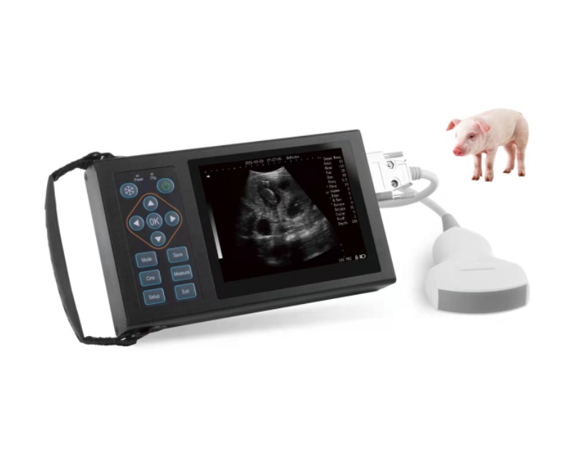 Full Digital Ultrasonic Diagnostic Instrument