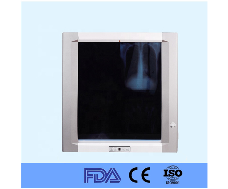 Hospital LED X Ray medical film viewer
