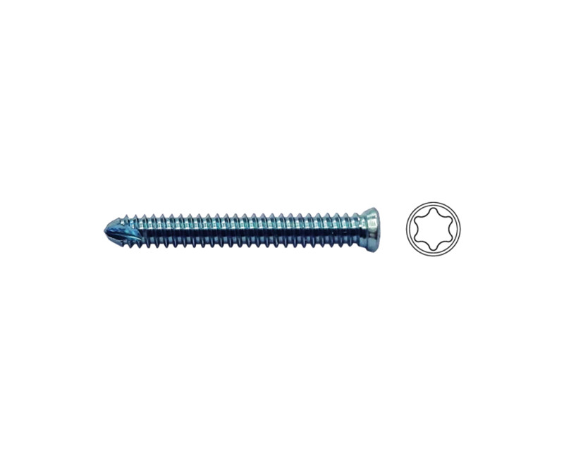 B2.4mm Locking Self Tapping Screws, T6 Torx Matching with ALPS 5/6.5 B2.4mm Locking Self Tapping Screws, T6 Torx Matching with ALPS 5/6.5