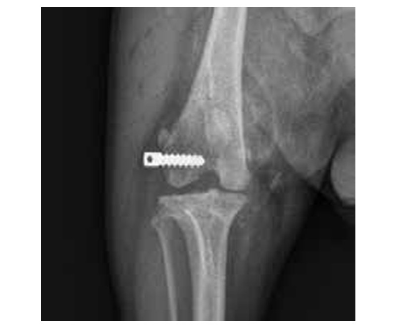Suture Anchor Pin