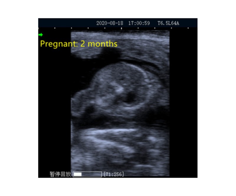 Full Digital Ultrasonic Diagnostic Instrument  WMV-A20