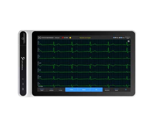 Veterinary ECG Machine  Model:WMV660C