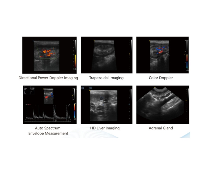 WMV-P5-VET VETERINARY COLOR DOPPLER ULTRASOUND SYSTEM