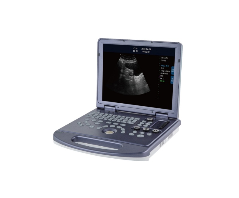 WMV-MU15 VETERINARY ULTRASOUND DIAGNOSTIC SYSTEM