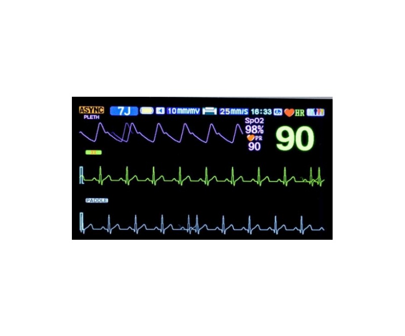 WMV500B Biphasic Defibrillator Monitor