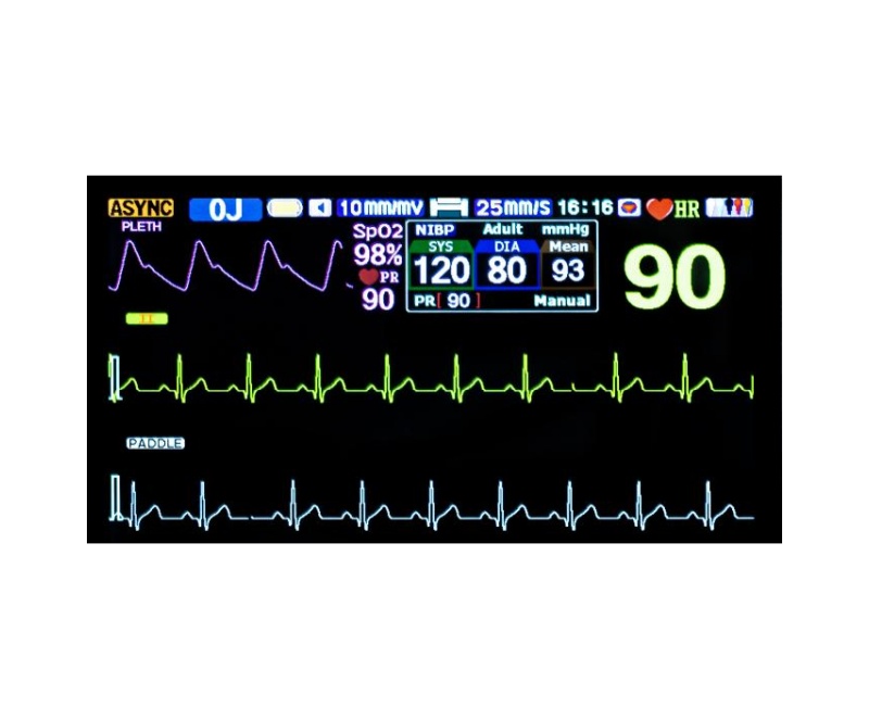 WMV500C Biphasic Defibrillator Monitor